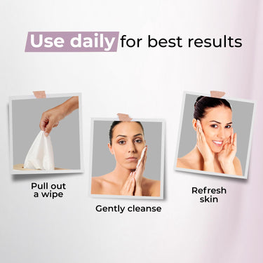 Kaya Clinic Refreshing Mattifying Wipes | Vitamin E & Chamomile Extracts | Face Wipes | Cleansing Wipes | For Acne Prone Skin | 30 Wipes